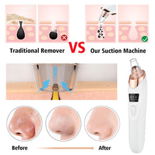 Load image into Gallery viewer, Vacuum Electric Blackhead Remover Cleaner
